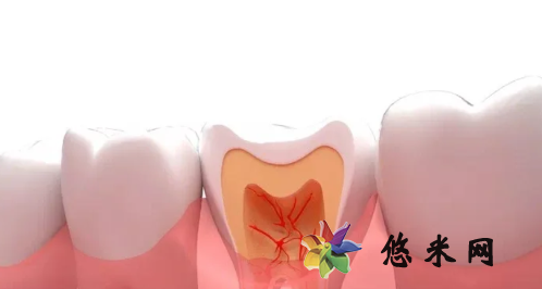 拔牙后频繁吞口水会影响出血量吗 拔牙后